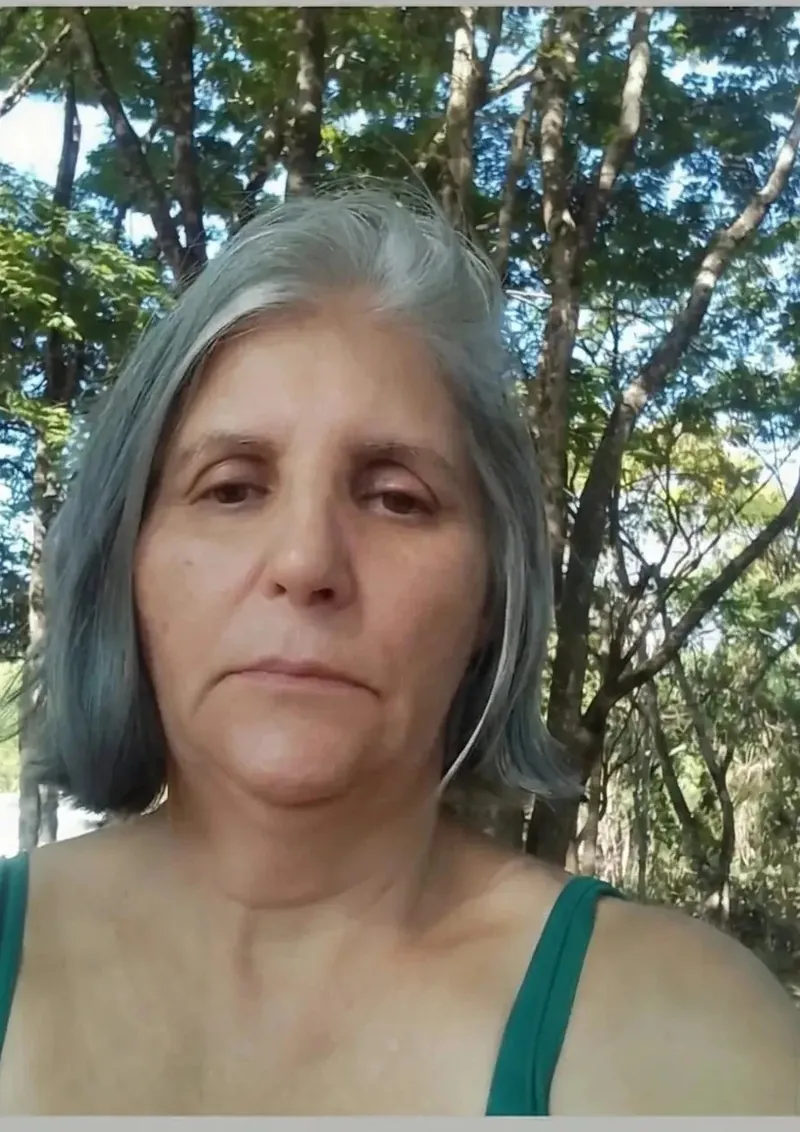 Cliente antes de usar o Vellessa Sérum